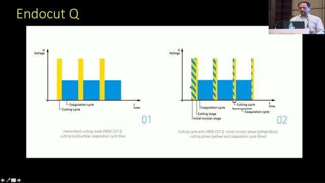 3rd International NBI/ESD/3rd Space Endoscopy Workshop Day 2, Pune 2017 смотреть онлайн