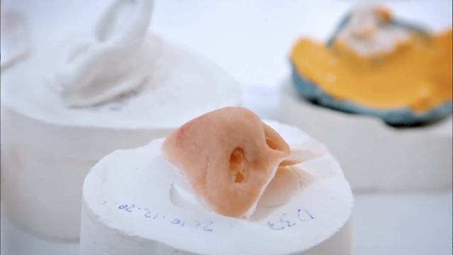 Per-Ingvar Brånemark - Titanium fixture and anchoring device for implants смотреть онлайн