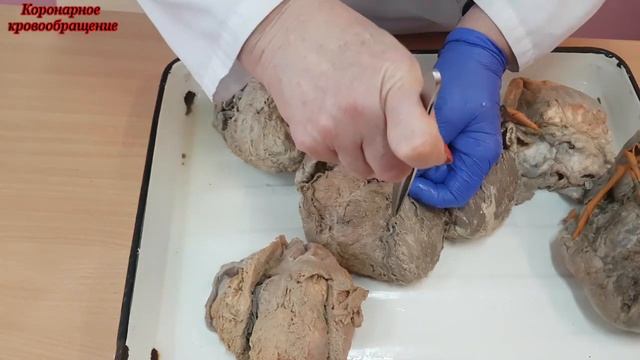 Кровоснабжение сердца ❤. Коронарное кровообращение. ⚘