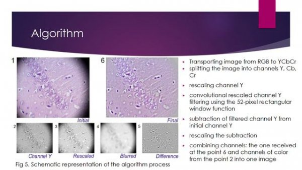 An algorithm of the preprocessing optical microscopy image.