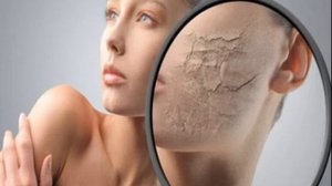Грибковые заболевания кожи: как их избежать?
