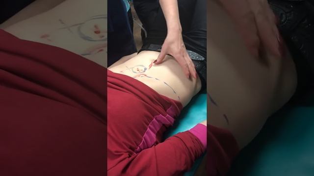 Висцеральный массаж семинар 10