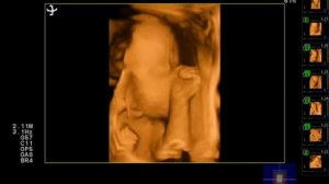 4D плода 27 недель беременности