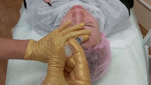 АирисКом студенты учатся: показ для студентов. Мезопилинг. смотреть онлайн