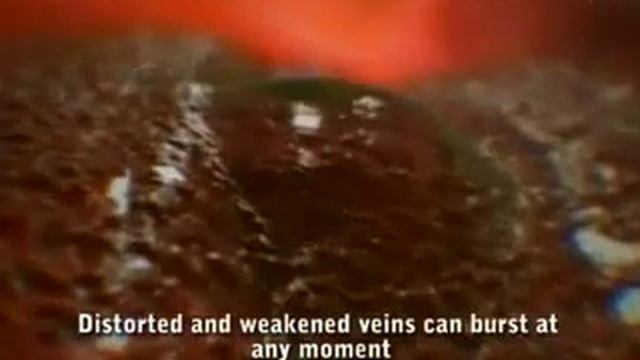 Береги себя. Пищевод.flv смотреть онлайн