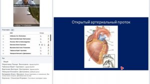 Врожденные пороки сердца у взрослых.mp4