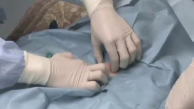 ПДТ комбинрованная методика PDT_Portex_Ciglia-Griggs R-hand full(6).mov смотреть онлайн