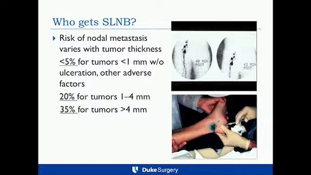 Questions for the Surgeon: What Do You Need a SLNB or Node Dissection смотреть онлайн