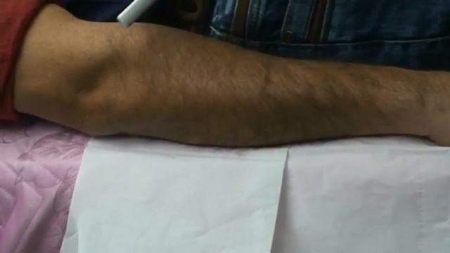 диодный лазер 808 нм для эпиляции ADSS FG2000C