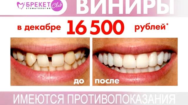 Новый рекламный ролик Виниров смотреть онлайн