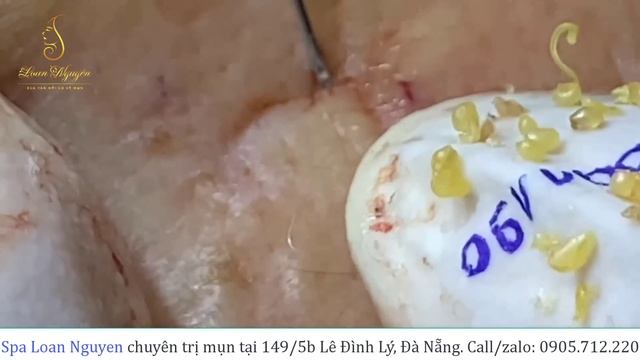 Pearl gold_part 2 of the previous customer (190) | Loan Nguyen смотреть онлайн