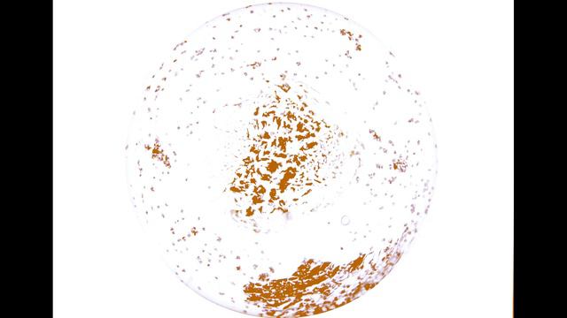 NEUTRALIZING TOXOPLASMA GONDII PARASITES | SCALAR ENERGY FIELD ( TESLA COIL ) смотреть онлайн