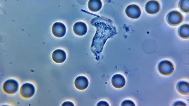 Нейтрофил фагоцитирует бактерию / Bacterial Phagocytosis By Neutrophil