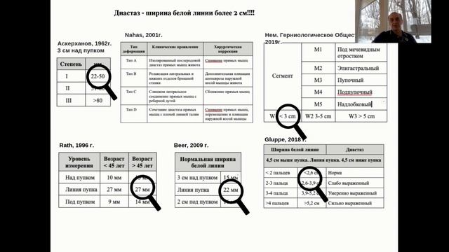 Аболмасов А. Пупочная грыжа, выбор оперативного вмешательства смотреть онлайн