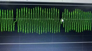 Ford Focus. Ошибка P0336. Неверный сигнал датчика коленвала.