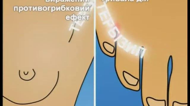 Ролик.Крем Тербизил www.studio11.com.ua смотреть онлайн