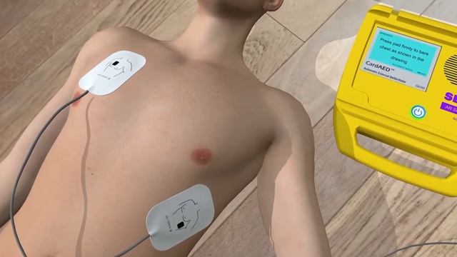 How to Use a Defibrillator (AED) in Augmented Reality смотреть онлайн