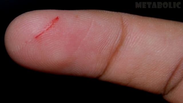 25 ВЕЩЕЙ, КОТОРЫЕ МОГУТ БЫТЬ ОПАСНЫМИ ДЛЯ ЗДОРОВЬЯ смотреть онлайн