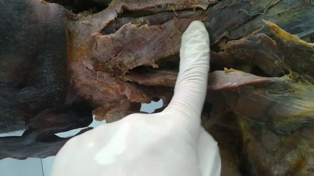 back superficial 02 смотреть онлайн