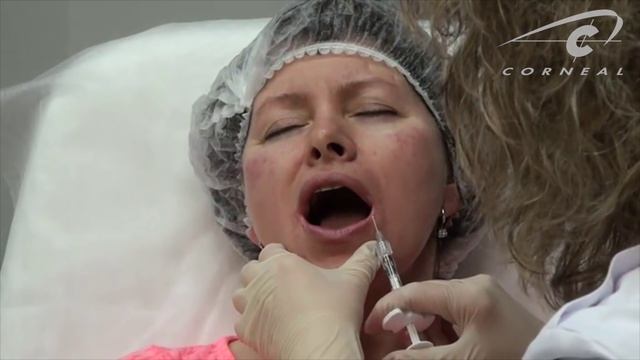 Губы - больно, зато красиво смотреть онлайн