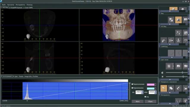 Работа с One Volume Viewer. Часть 3 смотреть онлайн