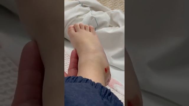 День пошел не совсем по плану! Обошлось без переломов. Недельный гипс для ушиба. Благодарю ! смотреть онлайн