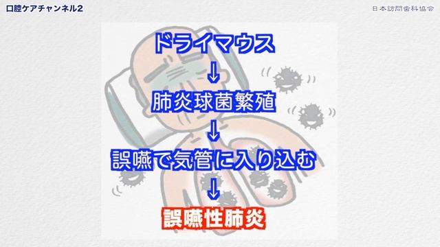 ドライマウスと誤嚥性肺炎の関係　口腔ケアチャンネル　603（口腔ケアチャンネル2　＃276） смотреть онлайн