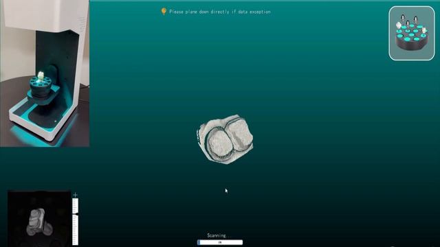 How dental scanners for orthodontics work. смотреть онлайн