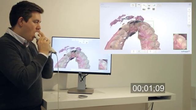 3Shape TRIOS skener - demo 1 смотреть онлайн