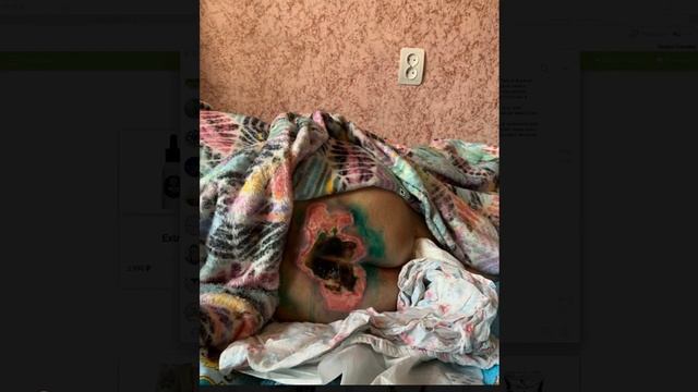 ⚡️Tayga8⚡️ Деме́нция, сахарный диабет, пролежни ТОЛЬКО ОТЗЫВЫ О ТАЙГА 8 смотреть онлайн