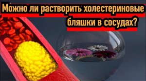 Можно ли растворить холестериновые бляшки в сосудах?