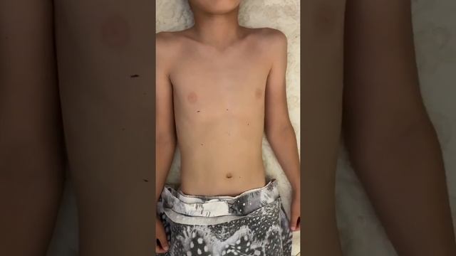 Пальпация живота и определение границы печени по Курлову смотреть онлайн