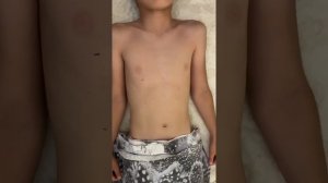 Пальпация живота и определение границы печени по Курлову