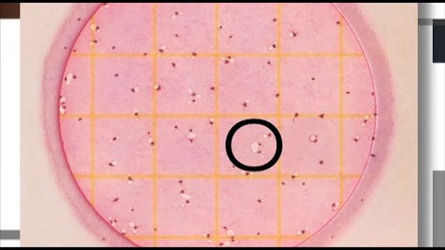 3M™ Petrifilm™ CC для подсчета колиформных бактерий смотреть онлайн