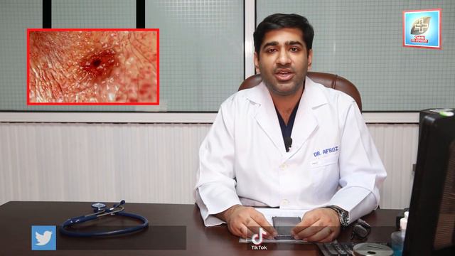 Maday Ke Ulcer Ki Alamat |Ulcer Signs, Symptoms in Urdu & Hindi смотреть онлайн