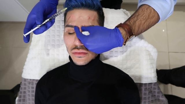 Botox: Before & After | Danny Defreitas смотреть онлайн