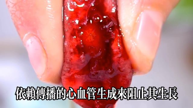 美國癌症研究所終於公布10大抗癌食物，咖啡竟也入圍第9名，第1名你一定猜不到，快看看有沒有你最愛吃的