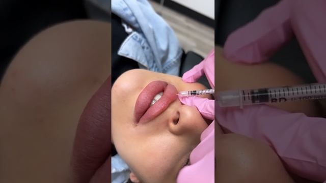 Добавили 1 мл ? #йошкарола #контурнаяпластика #контурнаяпластикагуб #косметология смотреть онлайн