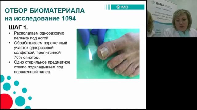 Вебинар для подологов. «Комплексный подход в работе подолога при подозрении на онихомикоз»