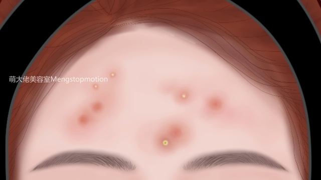 Skin Care Animation丨Pimple popping丨Acne treatment丨Meng's Stop Motion смотреть онлайн
