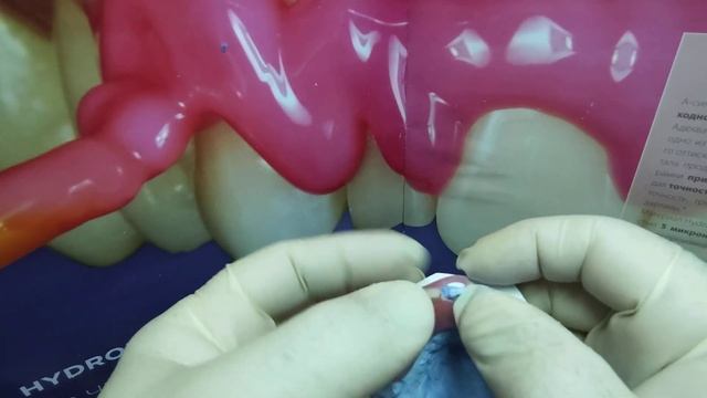 нейлоновый протез☝ смотреть онлайн