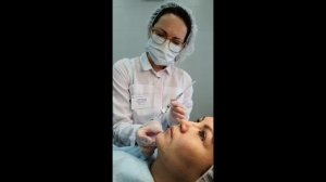 Коррекция морщин марионетки и подбородка