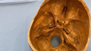 Основание головного мозга. 12 пар черепных нервов. Кровоснабжение головного мозга