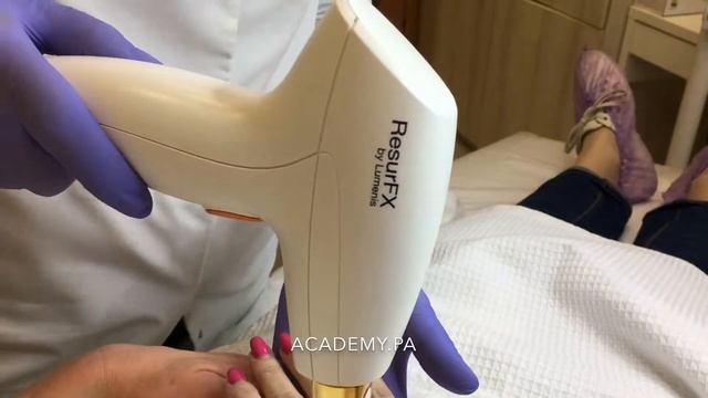 Сочетание процедуры М22 ResurFX + Geneo+ для омоложения и увлажнения кожи. 28.09.2018. смотреть онлайн