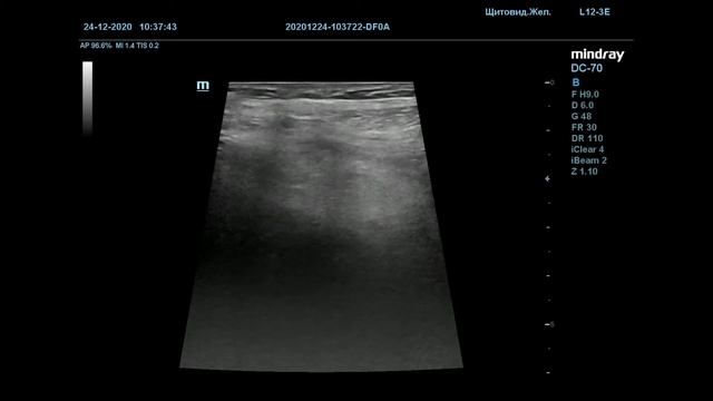 Острый аппендицит 24 12 20 смотреть онлайн