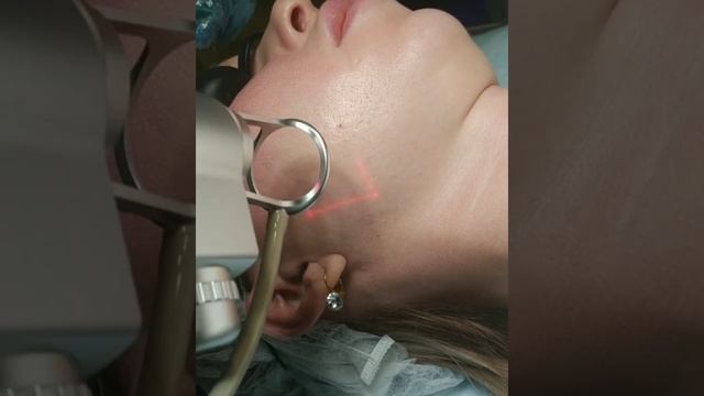 лазерная шлифовка СО2 лазером смотреть онлайн