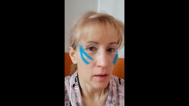 Круговая блефаропластика. Восстановление 20 день часть 1 из 186 дней. Клейте пластыри! Тейпирование