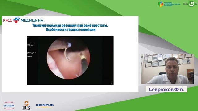 Другие нюансы ТУР гиперплазии простаты глазами эксперта. Севрюков Ф.А.