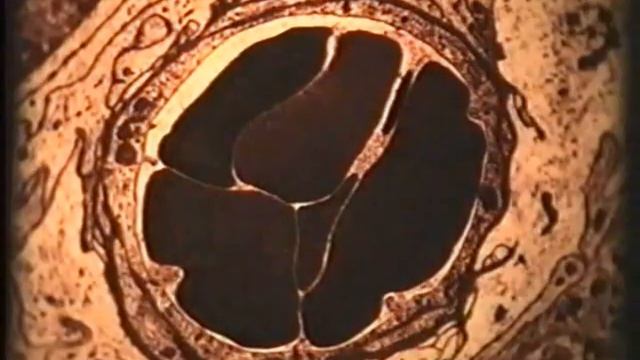 Орган слуха © The organ of hearing смотреть онлайн