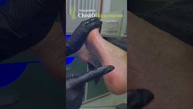 Было бы смешно, если бы не было так грустно ? #подологмосква #медицинскийпедикюр #подология смотреть онлайн